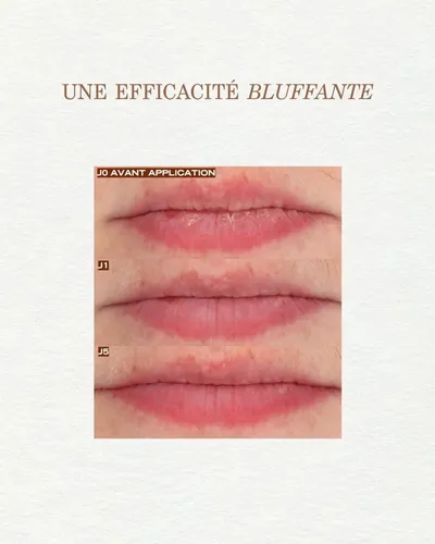 Avant 👉 Lèvres sèches, inconfortables, ternes…
Après 👉 Lèvres nourries, repulpées, irrésistibles ✨🍯

Notre Huile à Lèvres Source Nutrition agit comme une cuillerée de miel déposée délicatement sur vos lèvres.
✔ +12h d’hydratation continue
✔ Confort immédiat
✔ Fini brillant & gourmand sans coller
Une seule application, et vos lèvres se révèlent plus belles jour après jour. 💛🐝
 
#payotofficial #institutdebeauté #ebthionville #thionville #metz #luxemburg #beauty #lips